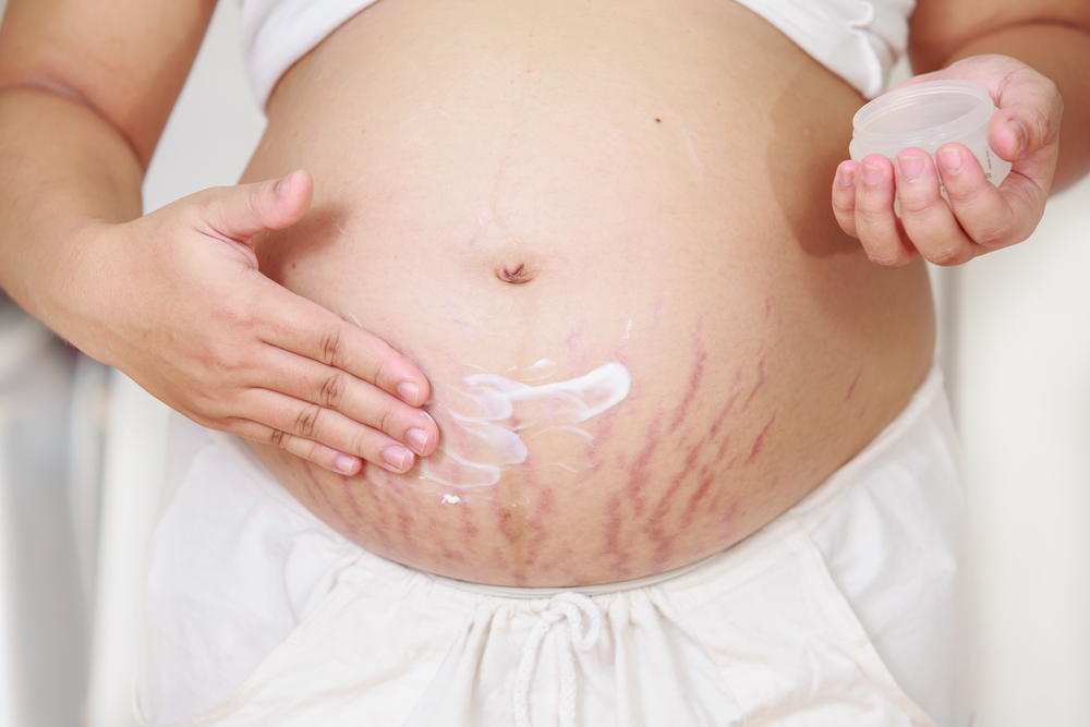 Young,Pregnant,Woman,Applying,Moisturizer,On,Her,Belly.