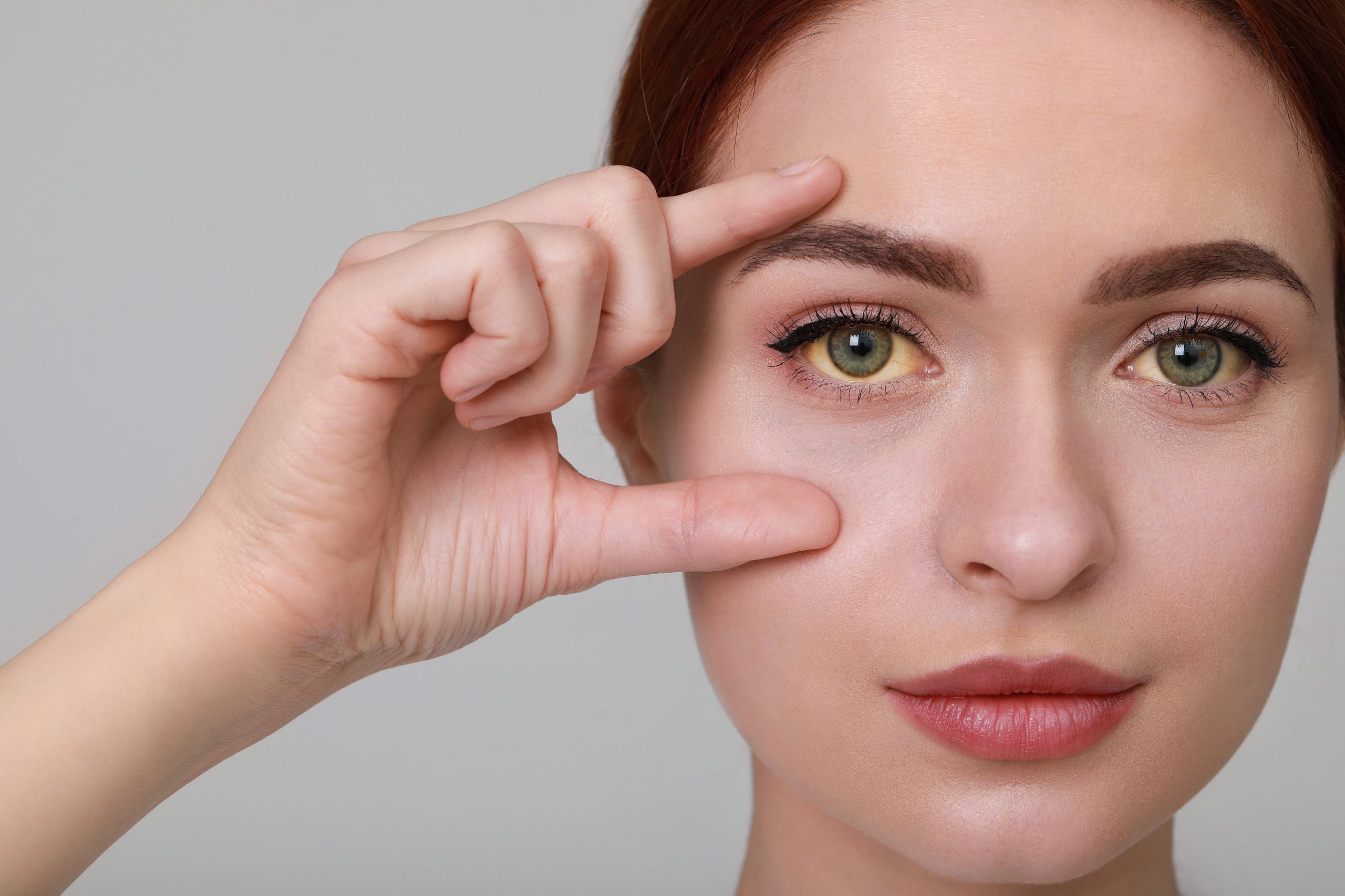 Frau mit gelben Augen auf hellgrauem Hintergrund. Symptom einer Hepatitis