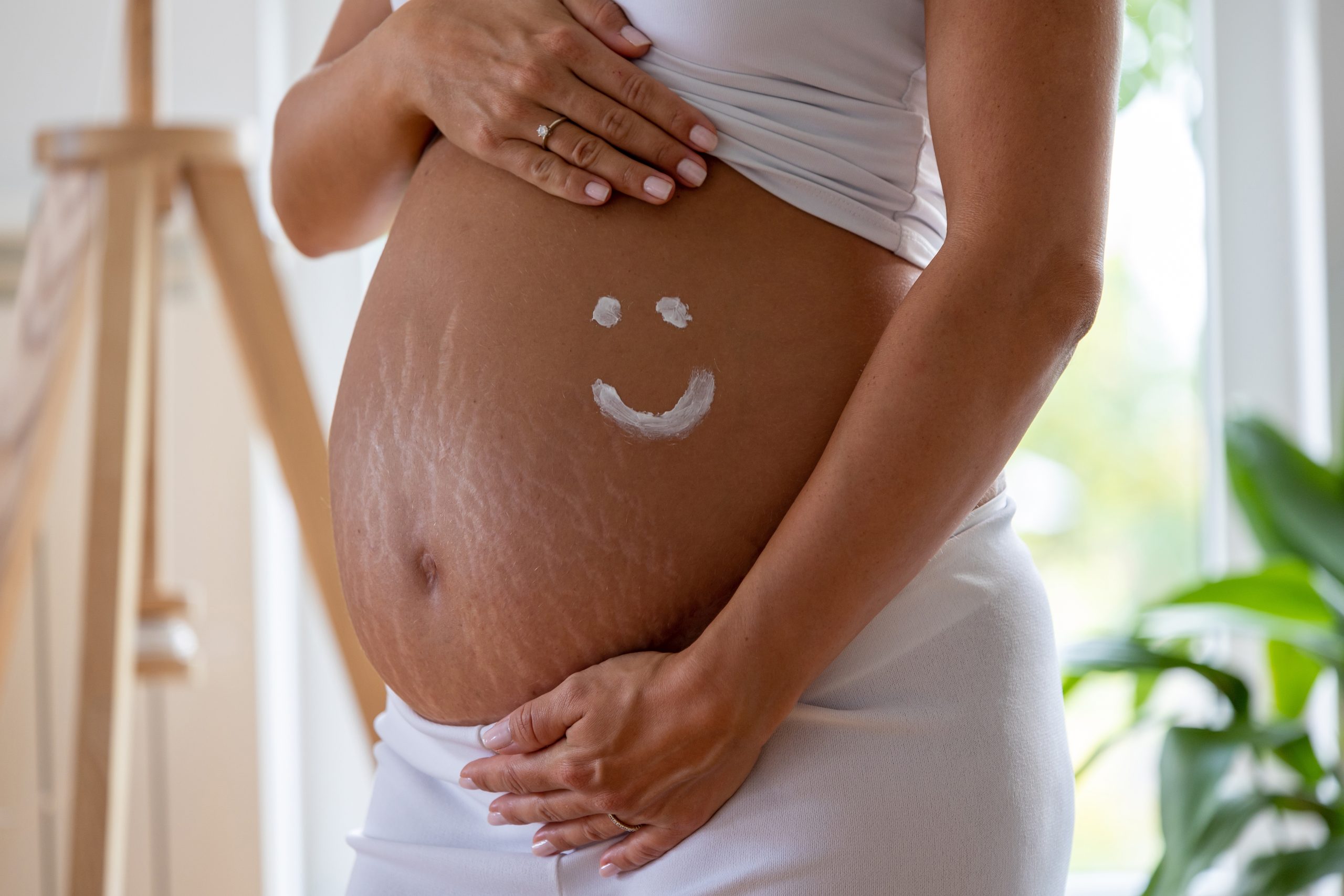 Eine schwangere Frau mit Schwangerschaftsstreifen.