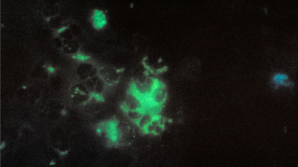 Immer mehr Fälle in Deutschland: So erkennt man die Papageienkrankheit