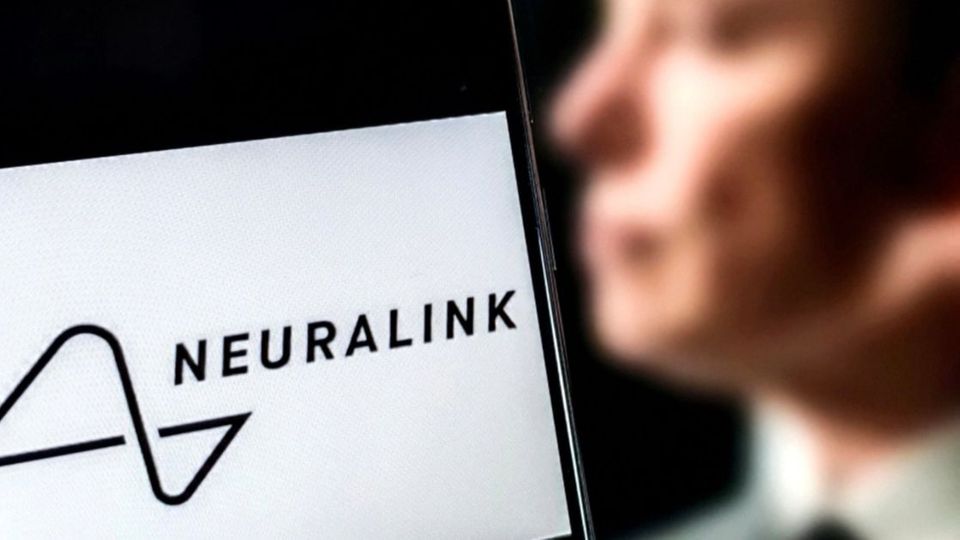 Musk-Unternehmen implantiert erstmals Gehirnchip