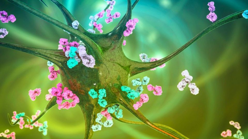 Multiple Sklerose: Diese Frühwarnzeichen können Jahre vor der Diagnose auftreten