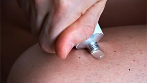 Neue Nebenwirkung bei Schmerzgelen festgestellt