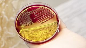 Gefährliches EHEC-Darmvirus ist zurück