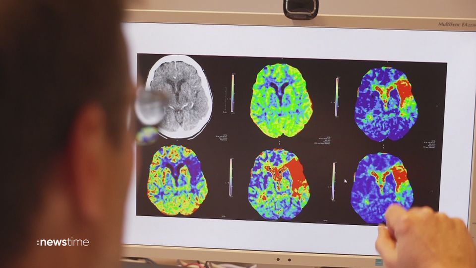 Schlaganfall: Schnelle Hilfe rettet Leben
