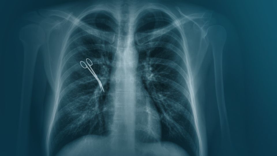 Tausende OP-Behandlungsfehler pro Jahr