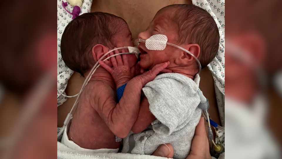 Zwillinge kämpfen nach Frühgeburt in Duisburg