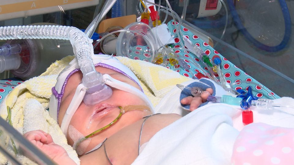 Weltfrühchentag: 8.000 Frühgeburten in NRW