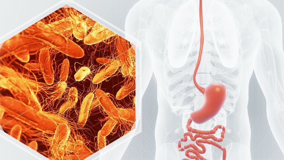 Neue Virus-Variante lässt Fallzahlen drastisch ansteigen