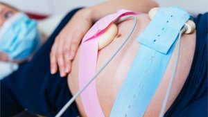 Jede zweite Geburtsklinik schlecht ausgestattet