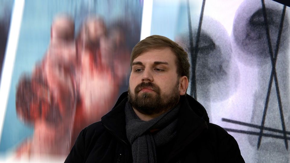 Seine Hand wurde von einem Böller zerfetzt