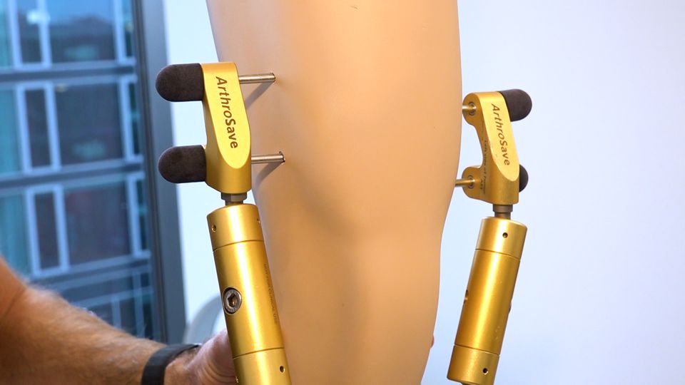 Arthrose-Behandlung: Neue Methode in NRW