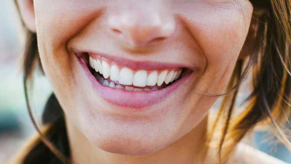 Was können Zahnzusatzversicherungen?