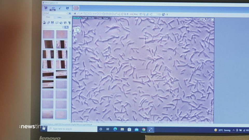 Über eine Million Tote pro Jahr: So entstehen Antibiotika-Resistenzen