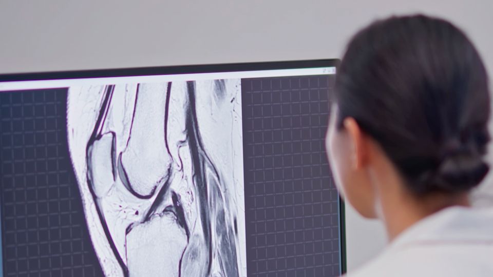 Gefahr für Gesundheit: Jedes 8. Röntgengerät fehlerhaft