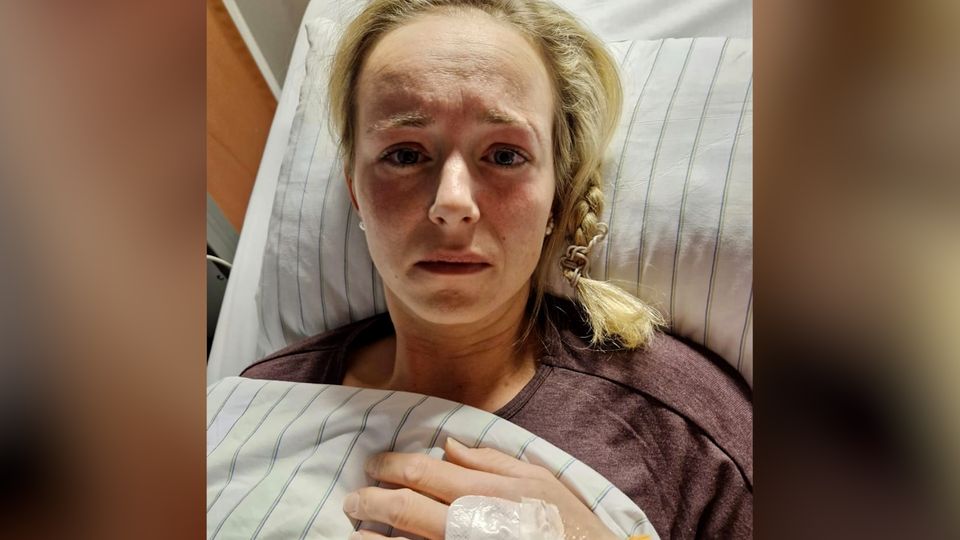Hantavirus-Patienten erklärt, wie sich die Erkrankung anfühlt
