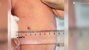 Schwangere angeschossen: Baby wird mit Kugel im Bauch geboren