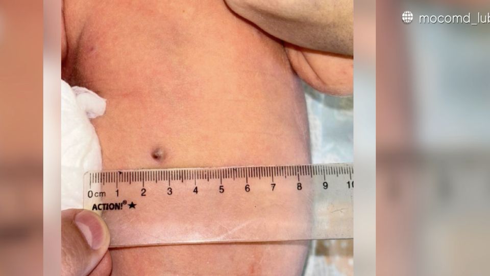 Schwangere angeschossen: Baby wird mit Kugel im Bauch geboren